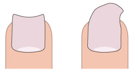 伸ばしすぎの爪イメージ